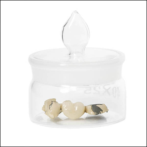 Tooth bridge in glass pot - part of tooth collection