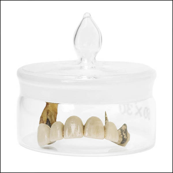 Tooth bridge in glass pot - part of tooth collection